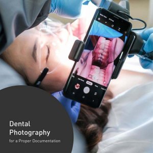 bộ thiệt bị chụp ảnh răng nha khoa