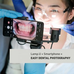 thiết bị nha khoa chụp hình răng